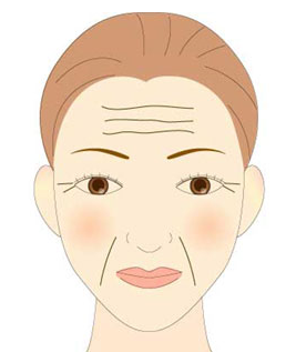 脸上皱纹的类型都有哪些 - 3023.com