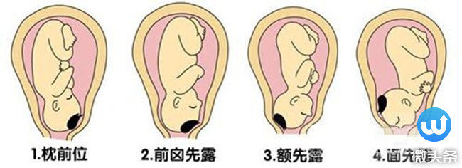 男尖女圆, 看孕妈肚子真能判定宝宝的性别吗?